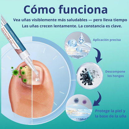 Lápiz Antihongos Extra Fuerte 25% Ácido Undecilénico