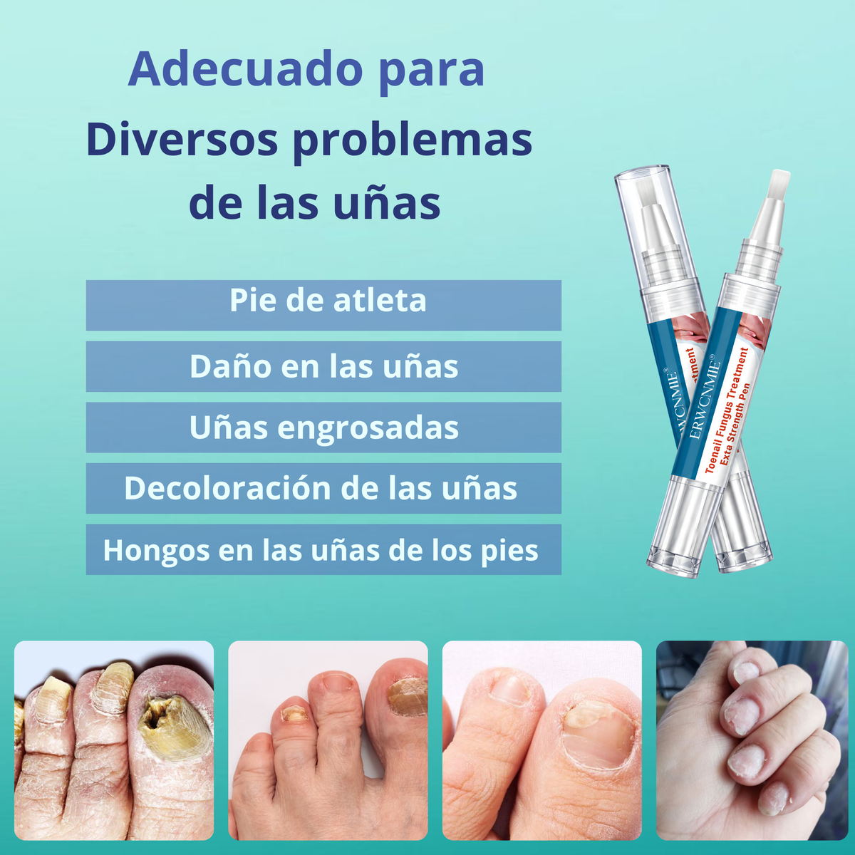 Lápiz Antihongos Extra Fuerte 25% Ácido Undecilénico